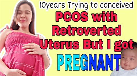 Para Mabilis Mabuntis: Retroverted Uterus .